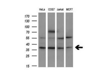 Western Blot: FGF basic/FGF2/bFGF Antibody (OTI3D9) - Azide and BSA Free [NBP2-70718] - Analysis of extracts (10ug) from 4 different cell lines by using anti-BFGF monoclonal antibody at 1:200 dilution