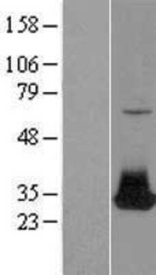 Western Blot FGF-12 Overexpression Lysate