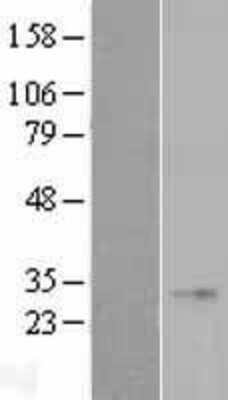 Western Blot: FGF23 Overexpression Lysate (Adult Normal) [NBL1-10696] Left-Empty vector transfected control cell lysate (HEK293 cell lysate); Right -Over-expression Lysate for FGF23.