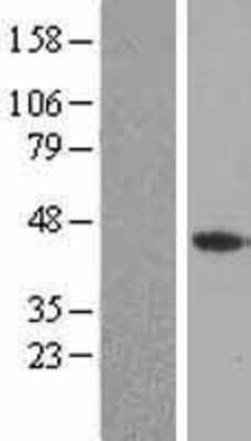 Western Blot: FGF4 Overexpression Lysate (Adult Normal) [NBP2-08157] Left-Empty vector transfected control cell lysate (HEK293 cell lysate); Right -Over-expression Lysate for FGF4.