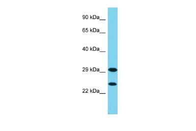 Western Blot: FGFBP3 Antibody [NBP2-82783] - Host: Rabbit. Target Name: FGFBP3. Sample Type: MCF7 Whole Cell lysates. Antibody Dilution: 1.0ug/ml