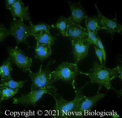 Immunocytochemistry/Immunofluorescence: FGFR1 Antibody (M17D10) [Alexa Fluor® 488] [NB100-2080AF488] - Ntera2 cells were fixed in 4% paraformaldehyde for 10 minutes and permeabilized in 0.05% Triton X-100 in PBS for 5 minutes. The cells were incubated with FGFR1 Antibody [M17D10] conjugated to Alexa Fluor 488 (NB100-2080AF488) at 10 ug/ml for 1 hour at room temperature. Nuclei were counterstained with DAPI (Blue). Cells were imaged using a 40X objective.