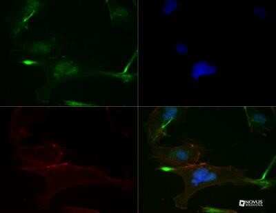 Immunocytochemistry/Immunofluorescence: FGFR1 Antibody (M17D10) - Azide and BSA Free [NBP2-80733] - FGFR1 (M17D10) antibody was tested in NTERA2 cells at 1:100 with DyLight 488 (Green) using a 40X objective. Actin and nuclei were counterstained with Phalloidin 568 (Red) and DAPI (Blue), respectively. Image from the standard format of this antibody.