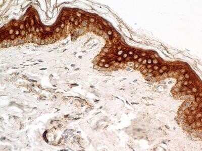 Immunohistochemistry-Paraffin: FGFR1 Antibody (M17D10) - Azide and BSA Free [NBP2-80733] - Analysis of FFPE tissue section of human normal skin using mouse monoclonal FGF R1 antibody (clone M17D10) at 5 ug/mL. Cells of the epidermal layer showed a very strong membrane-cytoplasmic staining with relatively weak nuclear immunopositivity for for th