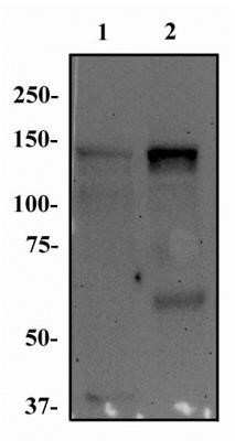 Western Blot: FGFR1 Antibody (M17D10) - Azide and BSA Free [NBP2-80733] - Total protein from MOLT-4 (lane 1) and Ntera-2 (lane 2) was separated on a 7.5% gel by SDS-PAGE. Protein was transferred to PVDF membrane, blocked and probed with 1 ug/mL of anti-FGF R1. FGF R1 protein was detected at ~150 kDa using an anti-mouse HRP secondary antibody. Image from the standard format of this antibody.