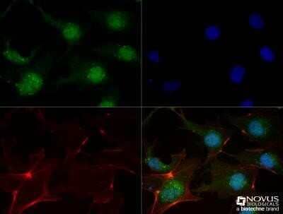 Immunocytochemistry/Immunofluorescence: FGFR1 Antibody (M2F12) - Azide and BSA Free [NBP2-80734] - NTERA2 cells were fixed for 10 minutes using 10% formalin and then permeabilized for 5 minutes using 1X TBS + 0.5% Triton-X100. The cells were incubated with FGR1 (M2F12) (NB120-829) at a 1:100 dilution overnight at 4 degrees Celsius and detected with Dylight 488 (Green) at a 1:500 dilution. Actin was detected with Phalloidin 568 (Red) at a 1:200 dilution. Nuclei were detected with DAPI (Blue) at 2.0 ug/ml in 1X PBS. Cells were imaged using a 40X objective. Image from the standard format of this antibody.