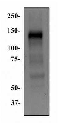 Western Blot: FGFR1 Antibody (M2F12) - Azide and BSA Free [NBP2-80734] - Total protein from Ntera-2 was separated on a 7.5% gel by SDS-PAGE. Protein was transferred to PVDF membrane, blocked and probed with 1 ug/ml of anti-FGFR1. FGFR1 protein was detected at approximately 150 kDa using an anti-mouse HRP secondary antibody. Image from the standard format of this antibody.