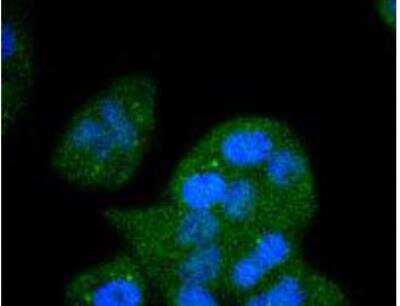 Immunocytochemistry/Immunofluorescence: FGFR1 Antibody (SD08-25) [NBP2-67794] - FGFR1 in Hela cells (green). The nuclear counter stain is DAPI (blue). Cells were fixed in paraformaldehyde, permeabilised with 0.25% Triton X100/PBS.