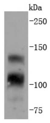 Western Blot: FGFR1 Antibody (SD08-25) [NBP2-67794] - Analysis of FGFR1 on 293 cells lysates using anti-FGFR1 antibody at 1/1,000 dilution.
