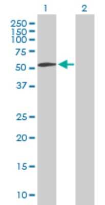 Western Blot: FGFR1OP Antibody [H00011116-B01P] - Analysis of FGFR1OP expression in transfected 293T cell line by FGFR1OP polyclonal antibody.  Lane 1: FGFR1OP transfected lysate(43.89 KDa). Lane 2: Non-transfected lysate.
