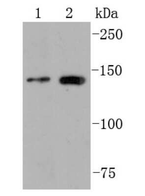 Western Blot: FGFR2 Antibody (JM10-60) [NBP2-66838] - Analysis of PGFR2 on different cell lysates using anti-PGFR2 antibody at 1/1,000 dilution. Positive control: Lane 1:MCF-7 Lane 2: Jurkat