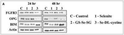 Western Blot: FGFR3 Antibody [NB600-1509] - Western blot analysis of apoptotic markers following 24 and 48 hrs of selenite (5 uM), GS-Se-SG (5 uM) and Se-DL-cystine (100 uM) treatment. Image collected and cropped by CiteAb from the following publication (onlinelibrary.wiley.com/doi/full/10.1111/jcmm.12214), licensed under a CC-BY license.