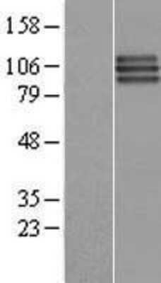 Western Blot FGFR3 Overexpression Lysate