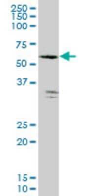 Western Blot: FGGY carbohydrate kinase domain containing Antibody (3B9) [H00055277-M04] - Analysis of expression in HeLa (Cat # L013V1).