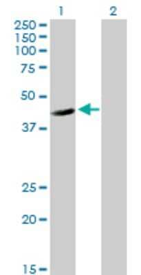 Western Blot: FGGY carbohydrate kinase domain containing Antibody [H00055277-B01P] - Analysis of FGGY expression in transfected 293T cell line by FGGY polyclonal antibody.  Lane 1: FLJ10986 transfected lysate(48.29 KDa). Lane 2: Non-transfected lysate.