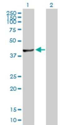 Western Blot: FGGY carbohydrate kinase domain containing Antibody [H00055277-D01P] - Analysis of FGGY expression in transfected 293T cell line by FGGY polyclonal antibody.Lane 1: FLJ10986 transfected lysate(47.70 KDa).Lane 2: Non-transfected lysate.