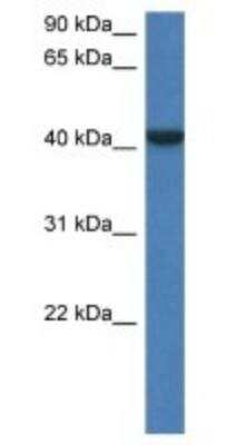 Western Blot: FGGY carbohydrate kinase domain containing Antibody [NBP1-79275] - Mouse Kidney lysate, concentration 1 ug/ml.