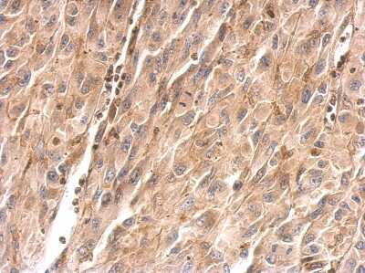 Immunohistochemistry-Paraffin: Hepassocin/FGL1 Antibody [NBP2-16486] - U87 xenograft.  FGL1 antibody dilution: 1:500. Antigen Retrieval: Trilogy™ (EDTA based, pH 8.0) buffer, 15min