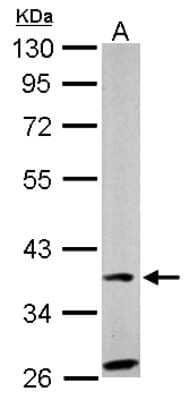 Western Blot: Hepassocin/FGL1 Antibody [NBP2-16486] -  Sample (50 ug of whole cell lysate) A: Mouse Liver, 10% SDS PAGE gel, diluted at 1:1000.
