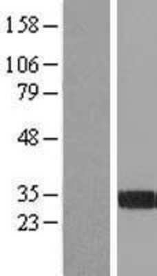Western Blot: FGL1 Overexpression Lysate (Adult Normal) [NBP2-04595] Left-Empty vector transfected control cell lysate (HEK293 cell lysate); Right -Over-expression Lysate for FGL1.