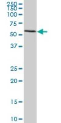 Western Blot: FGL2/Fibroleukin Antibody (5A10) [H00010875-M02] - FGL2 monoclonal antibody (M02), clone 5A10. Analysis of FGL2 expression in HeLa.