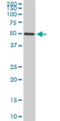 Western Blot: FGL2/Fibroleukin Antibody (5A10) [H00010875-M02] - FGL2 monoclonal antibody (M02), clone 5A10. Analysis of FGL2 expression in Raw 264.7.