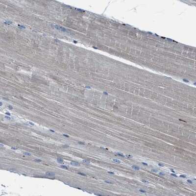 Immunohistochemistry-Paraffin: FGL2/Fibroleukin Antibody [NBP1-87198] - Staining of human skeletal muscle shows low expression as expected.