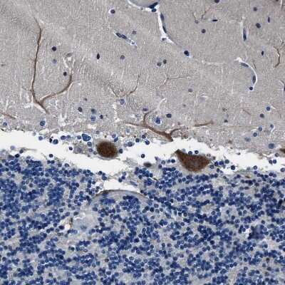 Immunohistochemistry-Paraffin: FGL2/Fibroleukin Antibody [NBP1-87198] - Staining of human cerebellum shows moderate cytoplasmic positivity in Purkinje cells.