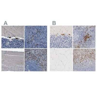 <b>Independent Antibodies Validation. </b>Immunohistochemistry-Paraffin: FGL2/Fibroleukin Antibody [NBP1-87198] - Staining of human cerebellum, lymph node, skeletal muscle and spleen using Anti-FGL2/Fibroleukin antibody NBP1-87198 (A) shows similar protein distribution across tissues to independent antibody NBP1-87199 (B).