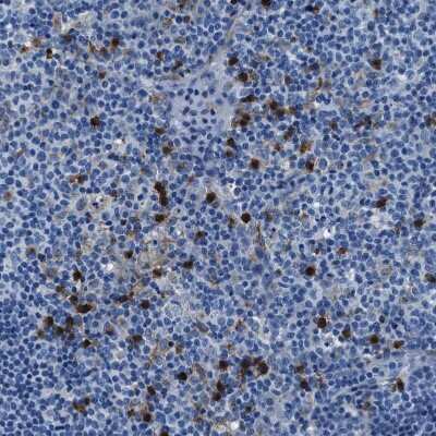 Immunohistochemistry-Paraffin: FGL2/Fibroleukin Antibody [NBP1-87198] - Staining of human lymph node shows strong cytoplasmic positivity in non-germinal center cells.