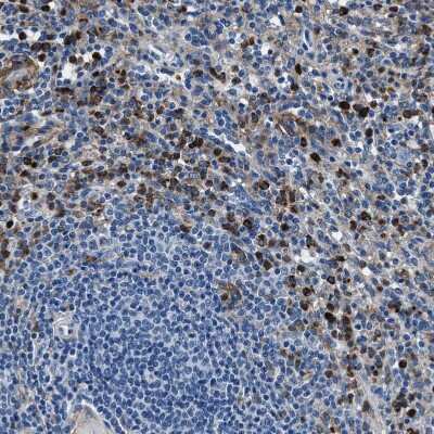 Immunohistochemistry-Paraffin FGL2/Fibroleukin Antibody - BSA Free