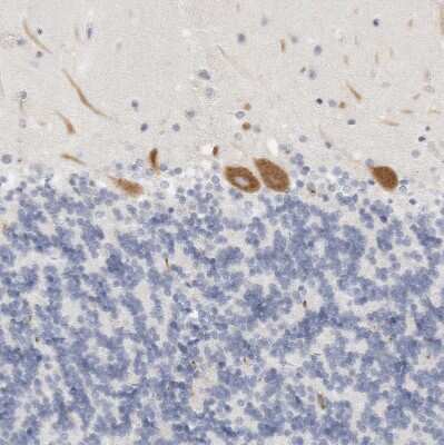 Immunohistochemistry-Paraffin: FGL2/Fibroleukin Antibody [NBP1-87199] - Staining of human cerebellum shows moderate cytoplasmic positivity in Purkinje cells.