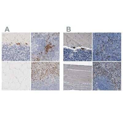 <b>Independent Antibodies Validation. </b>Immunohistochemistry-Paraffin: FGL2/Fibroleukin Antibody [NBP1-87199] - Staining of human cerebellum, lymph node, skeletal muscle and spleen using Anti-FGL2/Fibroleukin antibody NBP1-87199 (A) shows similar protein distribution across tissues to independent antibody NBP1-87198 (B).