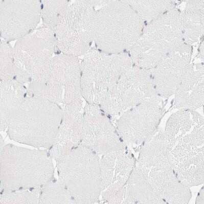 Immunohistochemistry-Paraffin: FGL2/Fibroleukin Antibody [NBP1-87199] - Staining of human skeletal muscle shows no positivity in myocytes as expected.