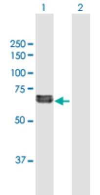Western Blot: FGL2/Fibroleukin Antibody [H00010875-B01P] - Analysis of FGL2 expression in transfected 293T cell line by FGL2 polyclonal antibody.  Lane 1: FGL2 transfected lysate(48.29 KDa). Lane 2: Non-transfected lysate.