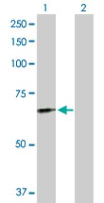 Western Blot: FGL2/Fibroleukin Antibody [H00010875-D01P] - Analysis of FGL2 expression in transfected 293T cell line by FGL2 polyclonal antibody.Lane 1: FGL2 transfected lysate(50.20 KDa).Lane 2: Non-transfected lysate.