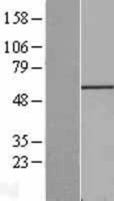 Western Blot: FGR Overexpression Lysate (Adult Normal) [NBP2-08351] Left-Empty vector transfected control cell lysate (HEK293 cell lysate); Right -Over-expression Lysate for FGR.