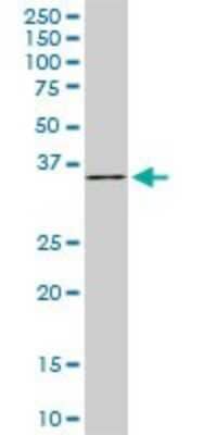 Western Blot: FHL1 Antibody (2A9) [H00002273-M01] - FHL1 monoclonal antibody (M01), clone 2A9. Analysis of FHL1 expression in NIH/3T3.