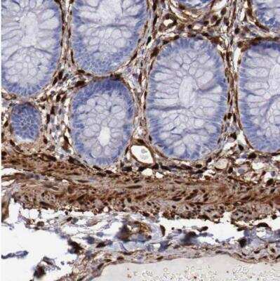 Immunohistochemistry-Paraffin: FHL1 Antibody [NBP1-88745] - Staining of human colon shows strong cytoplasmic positivity in smooth muscle cells.