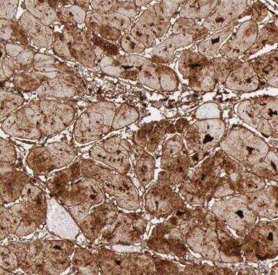 Immunohistochemistry-Paraffin: FHL1 Antibody [NBP1-88745] - Staining of human heart muscle shows strong cytoplasmic positivity in cardiomyocytes.