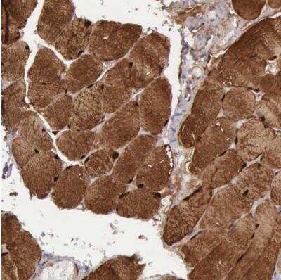 Immunohistochemistry-Paraffin: FHL1 Antibody [NBP1-88745] - Staining of human skeletal muscle shows strong cytoplasmic positivity in myocytes.