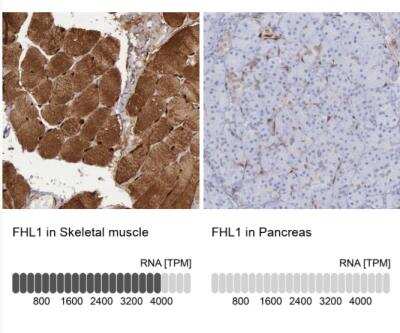 Immunohistochemistry-Paraffin: FHL1 Antibody [NBP1-88745] - Analysis human skeletal muscle and pancreas tissues.  Corresponding FHL1 RNA-seq data are presented for the same tissues