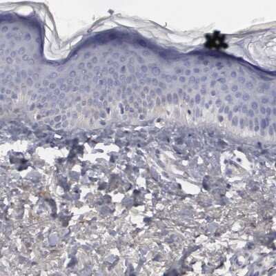 Immunohistochemistry-Paraffin: FHL1 Antibody [NBP1-88746] - Staining of human skin shows low expression as expected.