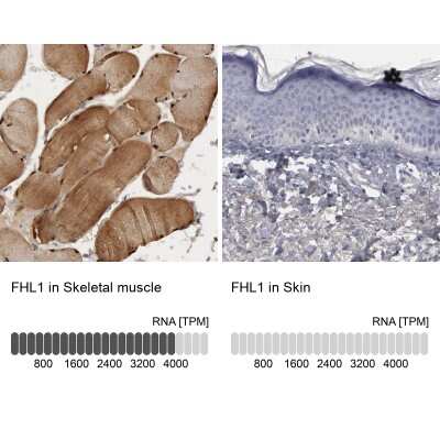 <b>Orthogonal Strategies Validation. </b>Immunohistochemistry-Paraffin: FHL1 Antibody [NBP1-88746] - Staining in human skeletal muscle and skin tissues using anti-FHL1 antibody. Corresponding FHL1 RNA-seq data are presented for the same tissues.