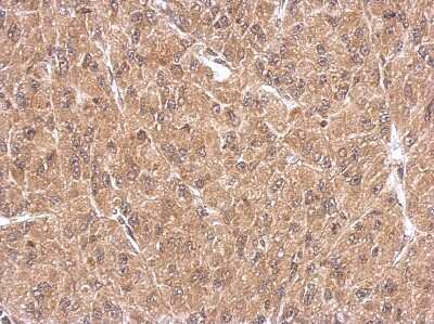 Immunohistochemistry-Paraffin: FHL1 Antibody [NBP2-16490] - U87 xenograft, using FHL1 antibody at 1:500 dilution. Antigen Retrieval: Trilogy™ (EDTA based, pH 8.0) buffer, 15min. 