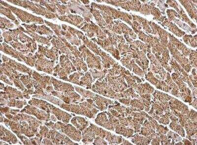 Immunohistochemistry-Paraffin: FHL1 Antibody [NBP2-16490] -  Mouse heart. FHL1 antibody dilution: 1:500. Antigen Retrieval: Trilogy™ (EDTA based, pH 8.0) buffer, 15min. 