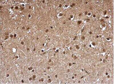 Immunohistochemistry-Paraffin: FHL1 Antibody [NBP2-16490] -  Mouse hind brain. FHL1 antibody dilution: 1:500. Antigen Retrieval: Trilogy™ (EDTA based, pH 8.0) buffer, 15min. 