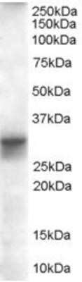 Western Blot: FHL1 Antibody [NB100-1461] - (0.01ug/ml) staining of Human Heart lysate (35ug protein in RIPA buffer). Primary incubation was 1 hour. Detected by chemiluminescence.