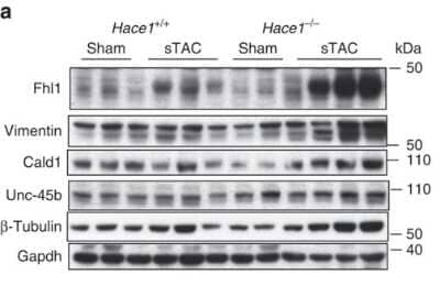 Western Blot: FHL1 Antibody [NB100-1461] - Proteins interacting with HACE1 accumulate in Hace1-/-sTAC heart.  Representative western blots show increased accumulation of some of the HACE1-interacting proteins in the Hace1-/-sTAC myocardium. n=3 mice per group, error bars represent s.e.m., P-value between KO and WT sTAC as indicated (one-way analysis of variance). GAPDH was used as a loading control.  Image collected and cropped by CiteAb from the following publication (//www.nature.com/articles/ncomms4430), licensed under a CC-BY license.