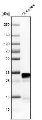 <b>Orthogonal Strategies Validation. </b>Western Blot: FHL1 Antibody [NBP1-88745] - Analysis in human skeletal muscle tissue.